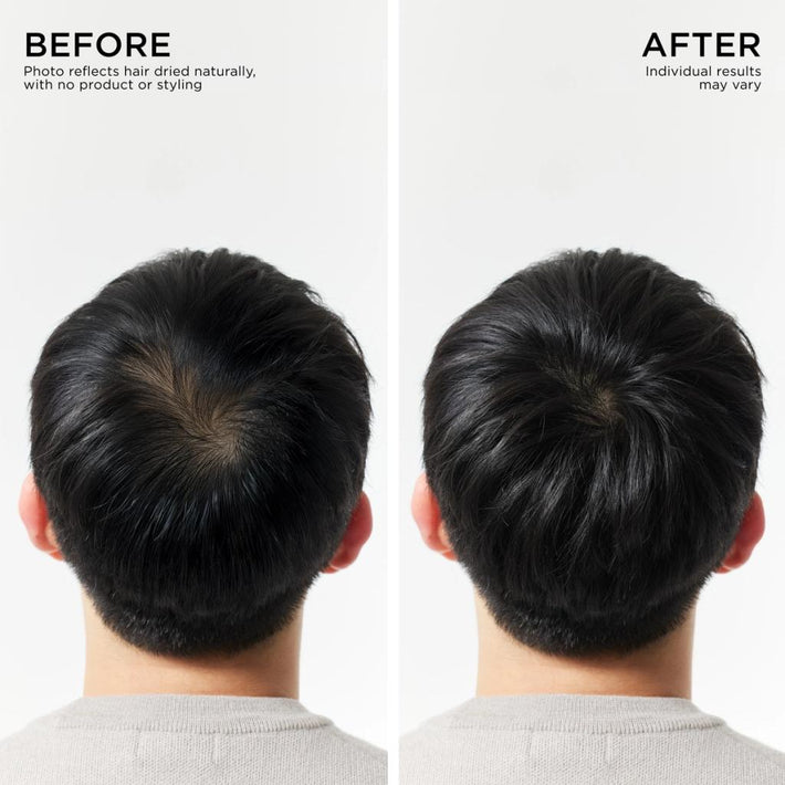 Before and After Results